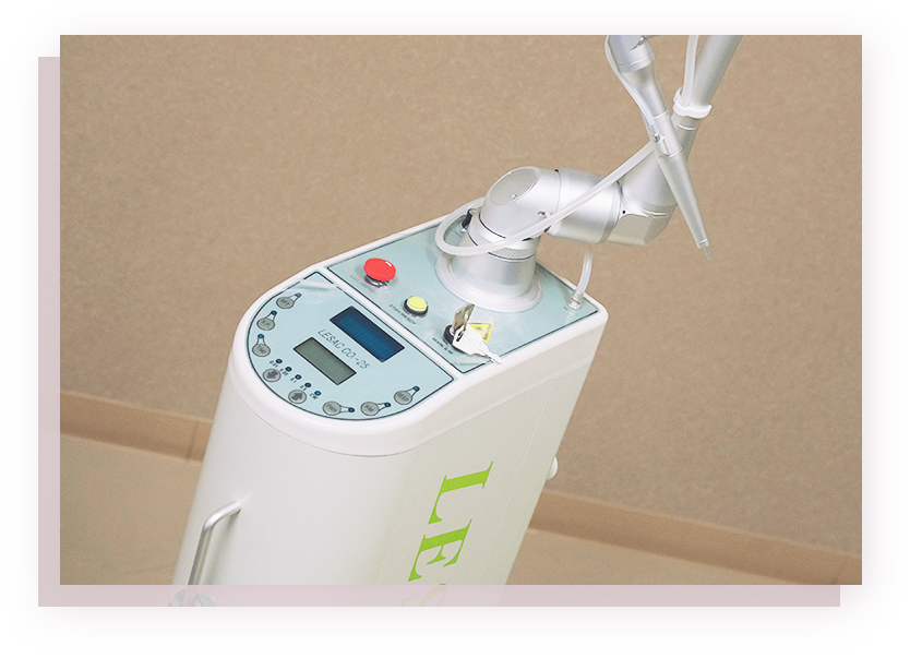 CO2レーザーによる子宮頸部レーザー蒸散術